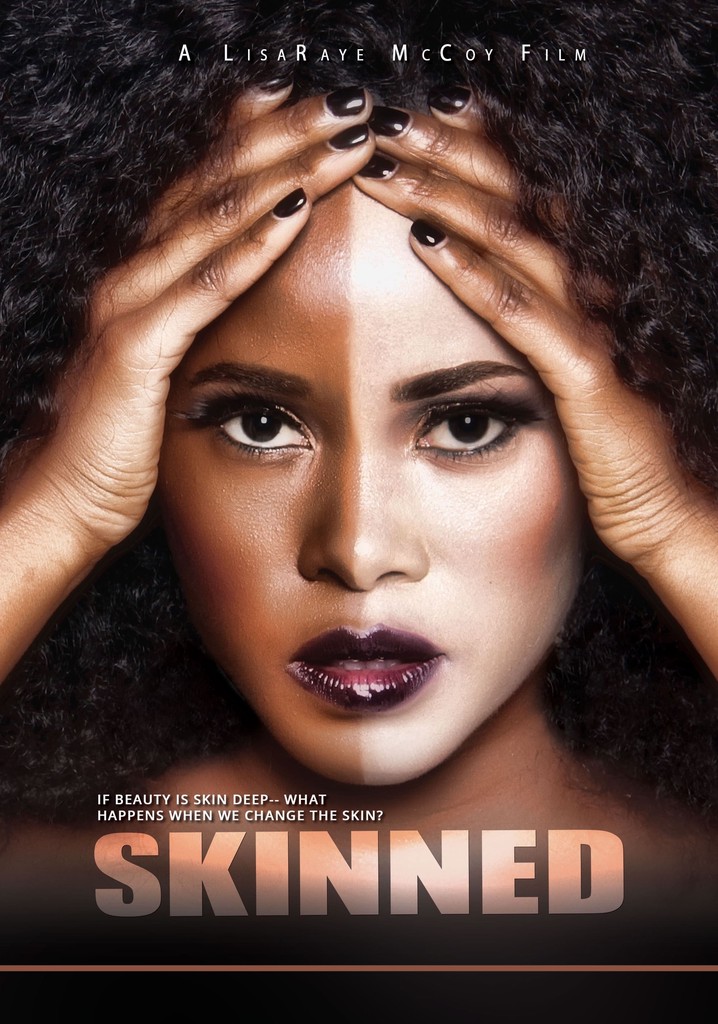 Skinned poster