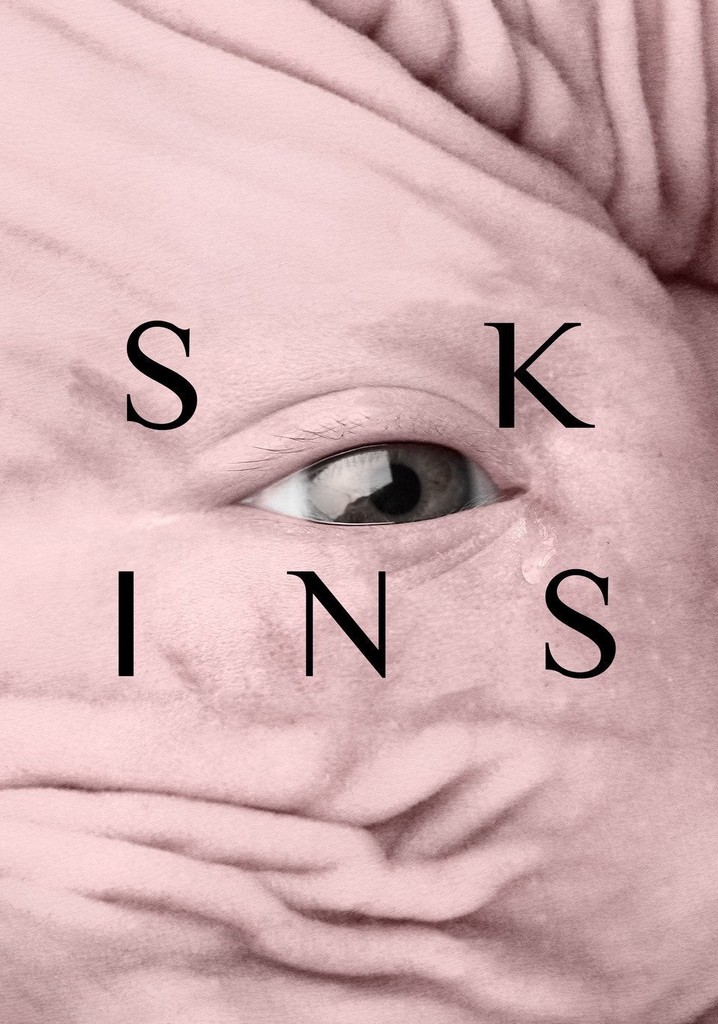 Skins poster