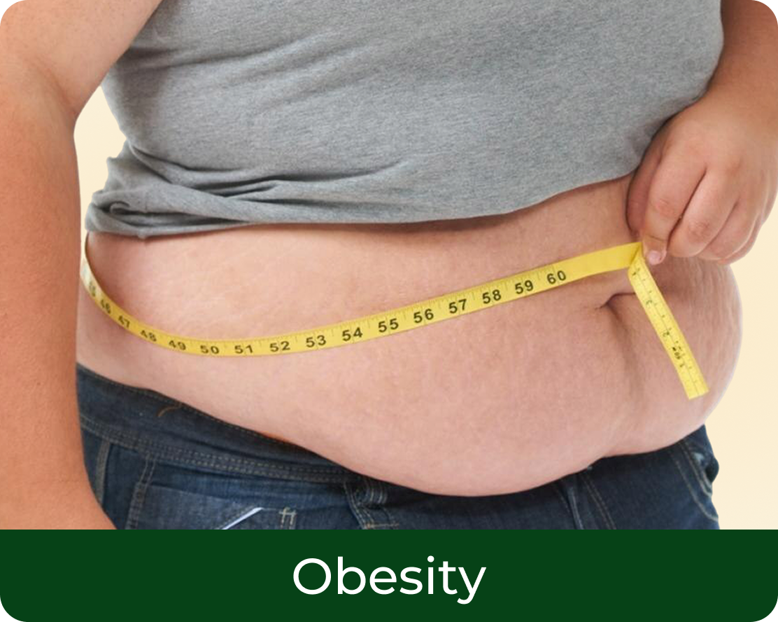 Obesity