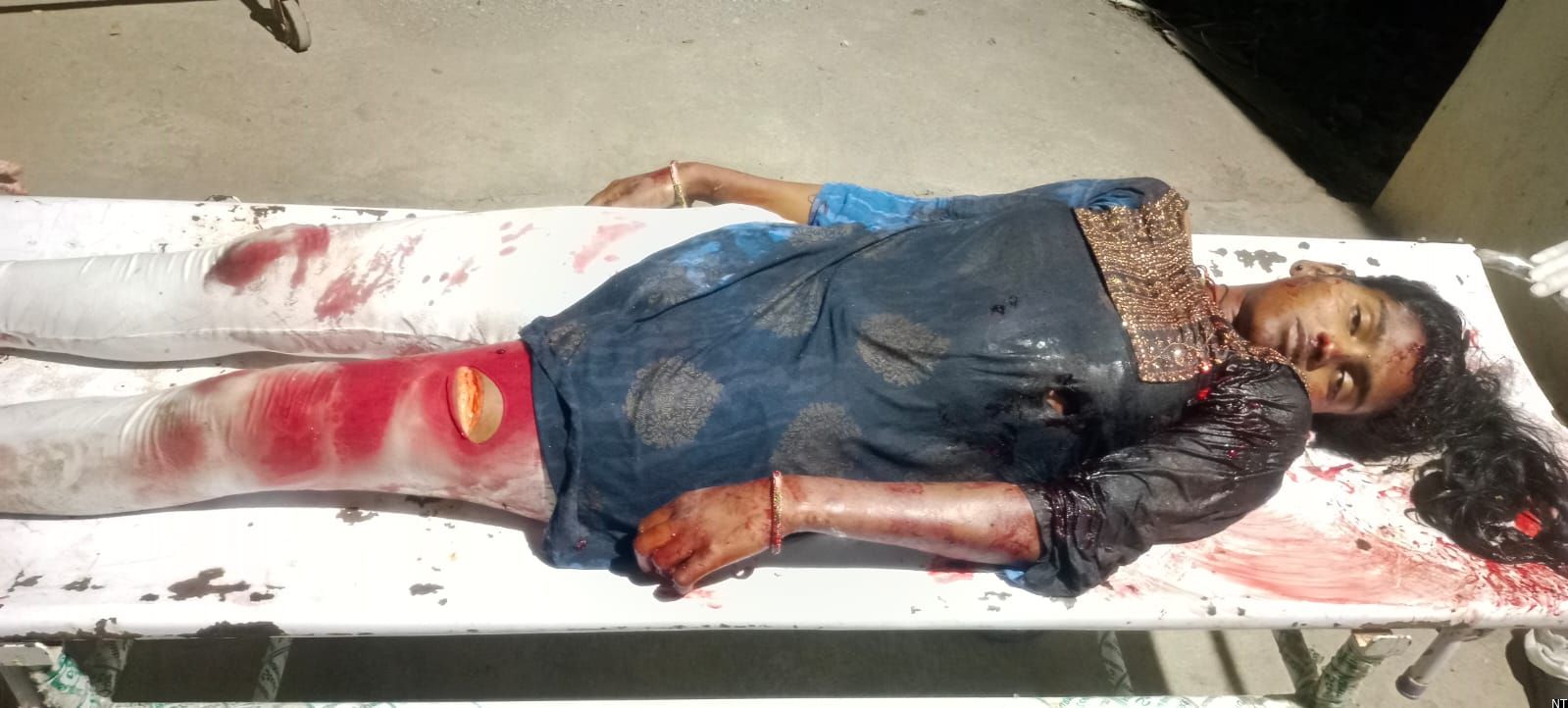 Police Probe Kodad Bus Stand Murder Case