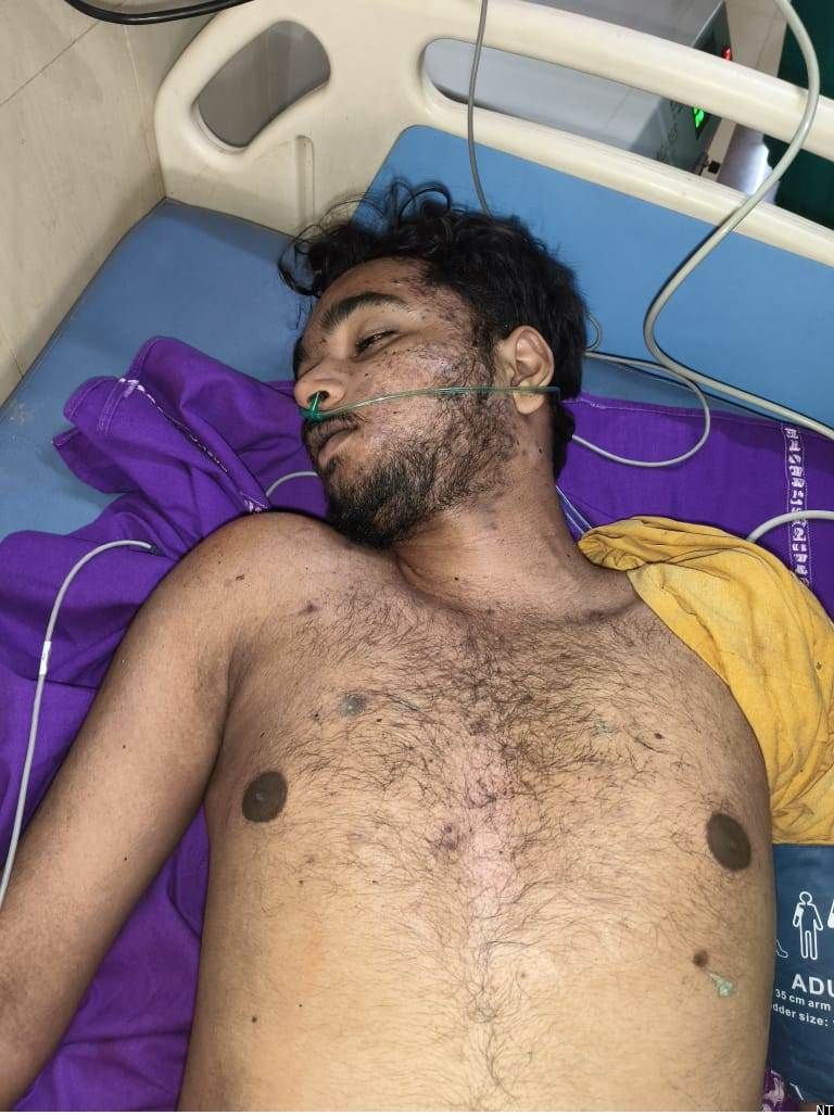 Police Probe Polluru Waterfall Drowning Incident