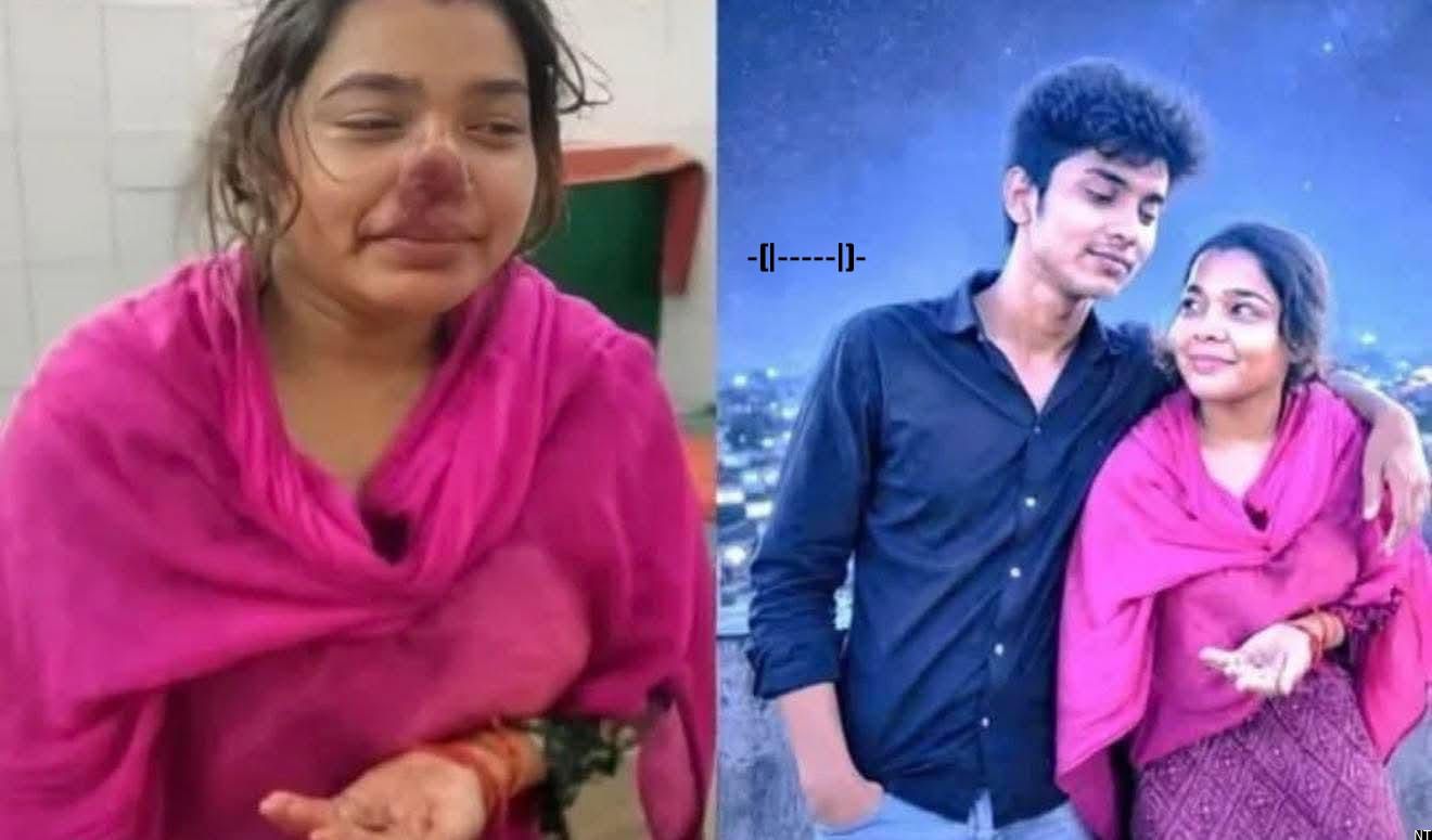 Police Probe Uttar Pradesh Nose Injury Incident