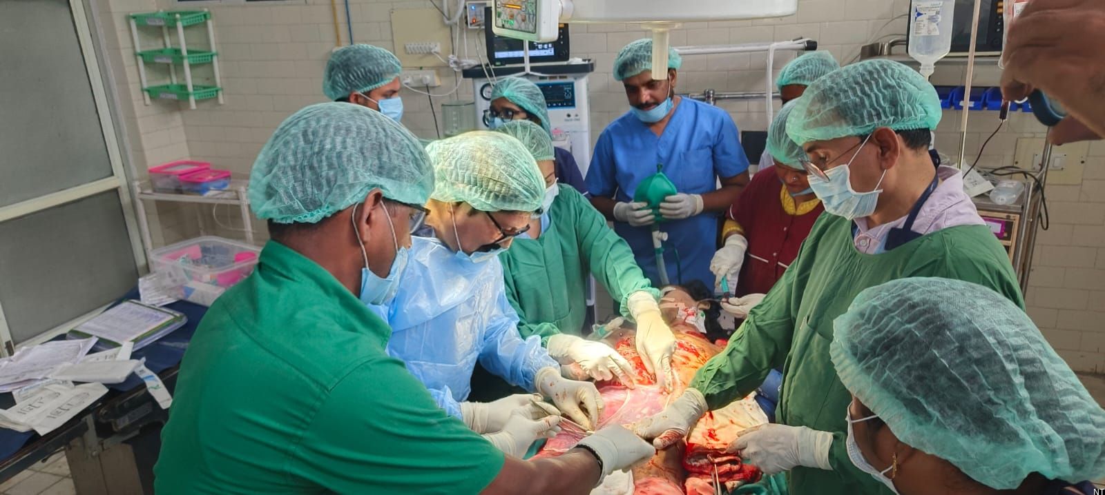 Bhadrachalam Area Hospital Performs Complex Burn Surgery
