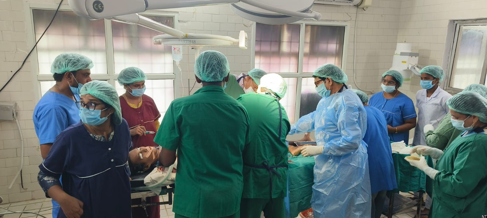 Medical team at Bhadrachalam Area Hospital following a successful complex surgery on a patient with severe burn injuries caused by electrocution.