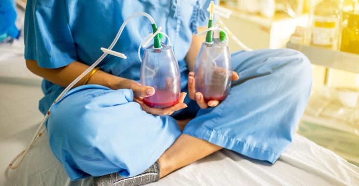 Dren Nedir? Ameliyat Sonrası Kullanımı ve Takibi image