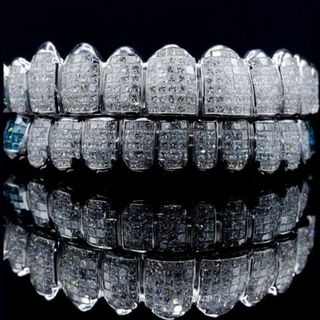 Diamond Gold Grillz