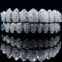 Diamond Gold Grillz