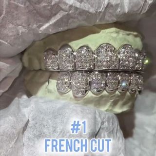 Diamond Gold Grillz