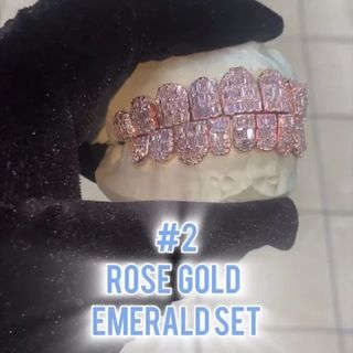 Diamond Gold Grillz