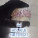 Diamond Gold Grillz