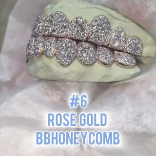 Diamond Gold Grillz