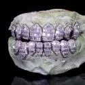 Diamond Gold Grillz
