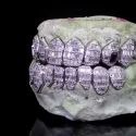 Diamond Gold Grillz