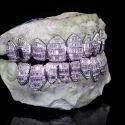 Diamond Gold Grillz