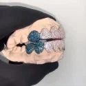 Diamond Gold Grillz