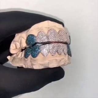 Diamond Gold Grillz