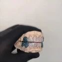 Diamond Gold Grillz