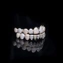 Diamond GriIlz On Teeth