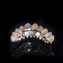 Diamond GriIlz On Teeth