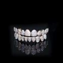 Diamond GriIlz On Teeth