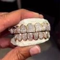 Diamond GriIlz On Teeth