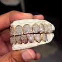 Diamond GriIlz On Teeth
