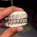 Diamond GriIlz On Teeth