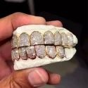 Diamond GriIlz On Teeth