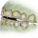 Diamond GriIlz On Teeth