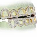 Diamond GriIlz On Teeth