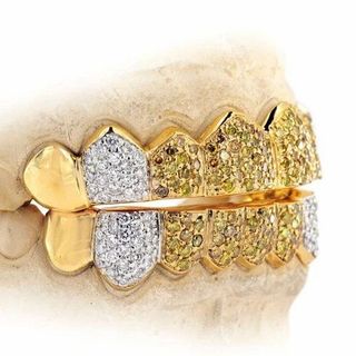 Diamond GriIlz On Teeth