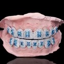 Diamond GriIlz On Teeth