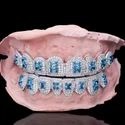 Diamond GriIlz On Teeth
