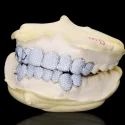 Diamond GriIlz On Teeth