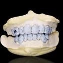 Diamond GriIlz On Teeth
