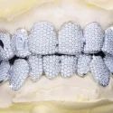 Diamond GriIlz On Teeth