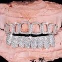 Diamond GriIlz On Teeth