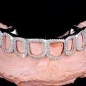 Diamond GriIlz On Teeth