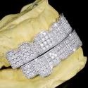 Diamond GriIlz On Teeth