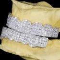 Diamond GriIlz On Teeth