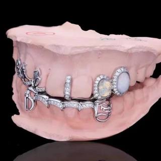 Diamond GriIlz On Teeth