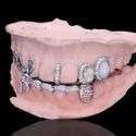 Diamond GriIlz On Teeth