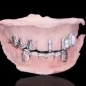 Diamond GriIlz On Teeth