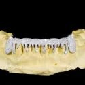 Diamond GriIlz On Teeth