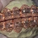Iced Out 925 Silver VVS Moissanite Teeth Grillz Custom Diamond Tester Approved Grillz