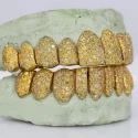 Iced Out 925 Silver VVS Moissanite Teeth Grillz Custom Diamond Tester Approved Grillz
