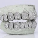 Iced Out 925 Silver VVS Moissanite Teeth Grillz Custom Diamond Tester Approved Grillz