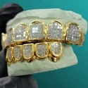 Iced Out 925 Silver VVS Moissanite Teeth Grillz Custom Diamond Tester Approved Grillz