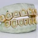 Iced Out 925 Silver VVS Moissanite Teeth Grillz Custom Diamond Tester Approved Grillz