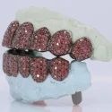 Iced Out 925 Silver VVS Moissanite Teeth Grillz Custom Diamond Tester Approved Grillz